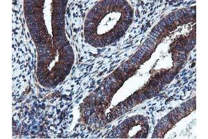 Immunohistochemical staining of paraffin-embedded Human endometrium tissue using anti-EPN2 mouse monoclonal antibody. (Epsin 2 anticorps)