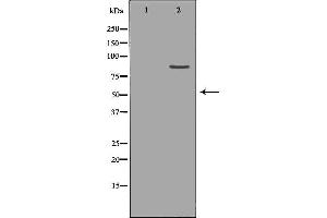 Western blot analysis of Hepg2 whole cell lysates, using CLCN5 Antibody. (Chloride Channel 5 anticorps  (Internal Region))