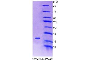 SDS-PAGE analysis of Human SLC30A3 Protein. (Slc30a3 Protéine)