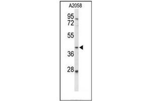 Western blot analysis of FUT3 Antibody (C-term) in A2058 cell line lysates (35ug/lane). (FUT3 anticorps  (C-Term))
