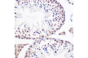 Immunohistochemistry of paraffin-embedded mouse testis using GMNN Rabbit pAb (ABIN6129382, ABIN6141186, ABIN6141187 and ABIN6220942) at dilution of 1:100 (40x lens). (Geminin anticorps  (AA 1-209))