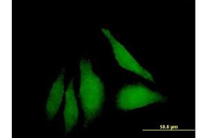 Immunofluorescence of purified MaxPab antibody to WDSUB1 on HeLa cell.