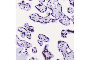 IHC analysis of RbAp48 using anti-RbAp48 antibody (ABIN5692929). (Retinoblastoma Binding Protein 4 anticorps  (C-Term))