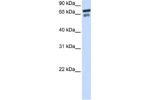 WB Suggested Anti-TCF25 Antibody Titration:  0. (TCF25 anticorps  (N-Term))
