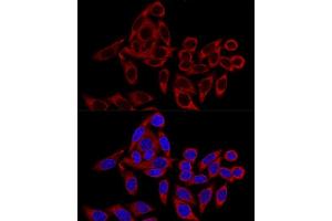 Confocal immunofluorescence analysis of HeLa cells using RRBP1 Polyclonal Antibody (ABIN6132872, ABIN6147259, ABIN6147260 and ABIN6215844) at dilution of 1:100. (RRBP1 anticorps  (AA 1-140))