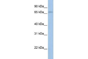 WB Suggested Anti-MAP3K2  Antibody Titration: 0.