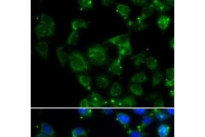 Immunofluorescence analysis of HeLa cells using MAPRE2 Polyclonal Antibody (MAPRE2 anticorps)