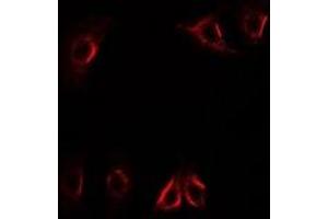 Immunofluorescent analysis of Axin-2 staining in U2OS cells.