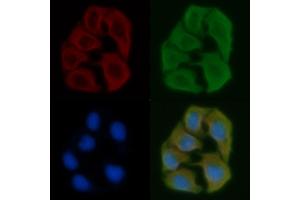 ABIN6257256 and ABIN6275187 staining Hela cells by IF/ICC.