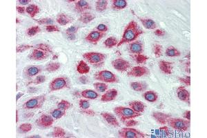 Human Placenta (LIMD1 anticorps  (N-Term))
