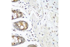 Immunohistochemistry of paraffin-embedded human colon using VEGFR3/FLT4 antibody (ABIN6130780, ABIN6140699, ABIN6140702 and ABIN6221242) at dilution of 1:200 (40x lens). (FLT4 anticorps  (AA 1174-1363))