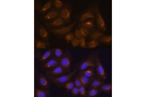 Immunofluorescence analysis of NIH/3T3 cells using Caspase-9 antibody (ABIN6131534, ABIN6137975, ABIN6137977 and ABIN6213766) at dilution of 1:100. (Caspase 9 anticorps  (AA 1-98))