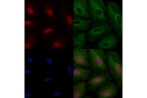 ABIN6264705 and ABIN6266630 staining  cells by IF/ICC. (Retinoic Acid Receptor beta anticorps  (Internal Region))
