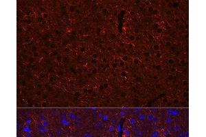 Immunofluorescence analysis of Mouse brain using GAD2 Polyclonal Antibody at dilution of 1:100 (40x lens). (GAD65 anticorps)