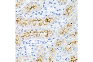 Immunohistochemistry of paraffin-embedded mouse kidney using IL17A antibody (ABIN6290529) at dilution of 1:100 (40x lens). (Interleukin 17a anticorps)