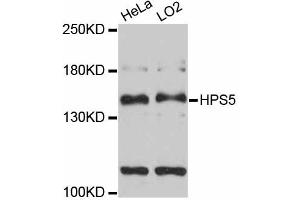 Western blot analysis of extracts of various cell lines, using HPS5 antibody (ABIN5997922) at 1:3000 dilution.