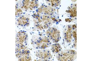 Immunohistochemistry of paraffin-embedded human stomach using SSTR2 antibody (ABIN5971606) at dilution of 1/100 (40x lens). (SSTR2 anticorps)