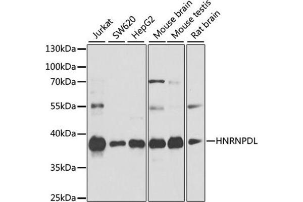 HNRPDL Antikörper  (AA 261-420)