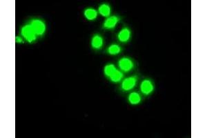 Image no. 1 for anti-Checkpoint Kinase 2 (CHEK2) antibody (ABIN1497495)