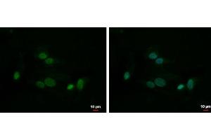 ICC/IF Image HMGB1 antibody detects HMGB1 protein at nucleus by immunofluorescent analysis. (HMGB1 anticorps)