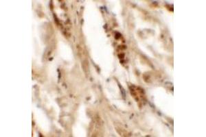 Immunohistochemistry of DBX2 in human kidney tissue with DBX2 antibody at 5 ug/mL. (DBX2 anticorps  (N-Term))