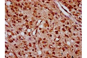 anti-Zinc Finger Protein 367 (ZNF367) (AA 83-151) antibody