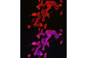 anti-Synuclein, alpha (SNCA) (AA 61-140) antibody