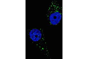 Fluorescent image of  cells stained with UVRAG (C-term) antibody. (UVRAG anticorps  (C-Term))