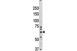 Western blot analysis of HRD1 antibody and mouse brain tissue lysate.