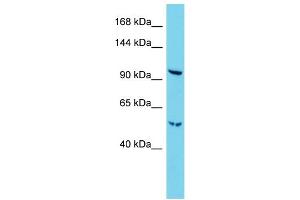 Host:  Rabbit  Target Name:  Radil  Sample Type:  Mouse Lung lysates  Antibody Dilution:  1. (Radil anticorps  (C-Term))