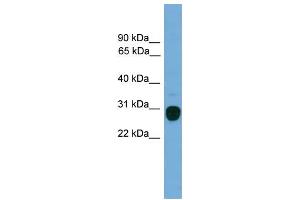 WB Suggested Anti-TREM2 Antibody Titration:  0. (TREM2 anticorps  (Middle Region))