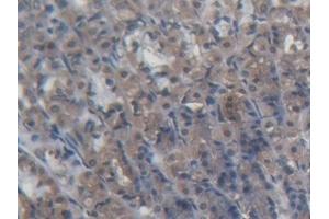 Detection of PDP2 in Rat Stomach Tissue using Polyclonal Antibody to Pyruvate Dehydrogenase Phosphatase 2 (PDP2)