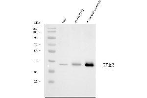 Western blot analysis of Tropomyosin 2/TPM2 using anti-Tropomyosin 2/TPM2 antibody (ABIN7603245).