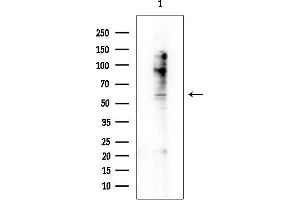 Western blot analysis of lysates from COLO205 cells, using KCN Antibody at 1/1000 dilution.