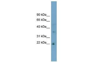 LDLRAD1 antibody used at 1 ug/ml to detect target protein. (LDLRAD1 anticorps  (Middle Region))