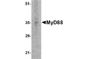 Western Blotting (WB) image for anti-Myeloid Differentiation Primary Response Gene (88) (MYD88) (AA 176-280) antibody (ABIN492527) (MYD88 anticorps  (AA 176-280))