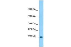 Image no. 1 for anti-S100 Calcium Binding Protein B (S100B) (AA 27-76) antibody (ABIN6748322) (S100B anticorps  (AA 27-76))