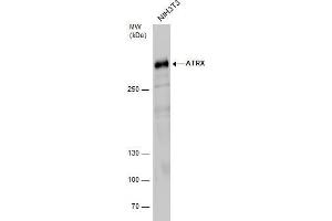WB Image ATRX antibody detects ATRX protein by western blot analysis.