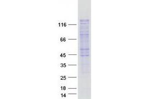 Validation with Western Blot
