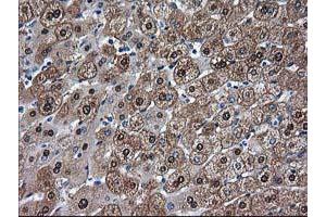 Immunohistochemical staining of paraffin-embedded Human liver tissue using anti-ADH1B mouse monoclonal antibody. (ADH1B anticorps)