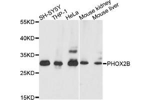 Western blot analysis of extracts of various cells, using PHOX2B antibody. (PHOX2B anticorps)