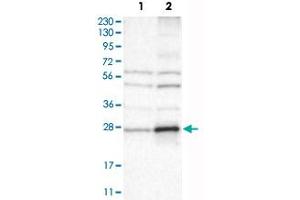 Western Blot analysis of Lane 1: RT-4 and Lane 2: U-251 MG sp cell lysates with CYBRD1 polyclonal antibody . (Cytochrome B Reductase 1 anticorps)