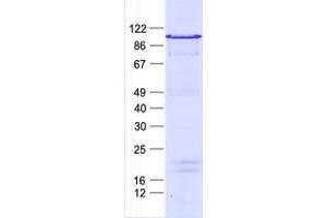 Validation with Western Blot