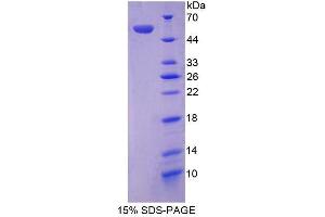 SDS-PAGE analysis of Mouse Angiotensinogen Protein.