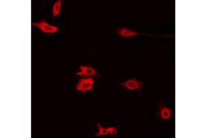 ABIN6272395 staining Hela by IF/ICC. (PXMP4 anticorps  (N-Term))