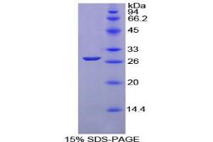 SDS-PAGE analysis of Chicken GSTm1 Protein. (GSTM1 Protéine)