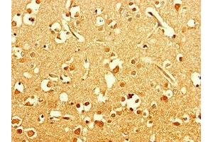Immunohistochemistry of paraffin-embedded human brain tissue using ABIN7151354 at dilution of 1:100 (ART5 anticorps  (AA 45-291))