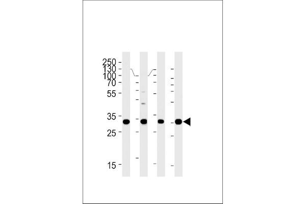 HOXB2 anticorps  (C-Term)
