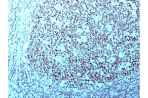 Formalin-fixed, paraffin-embedded human Tonsil stained with Nucleolin Monoclonal Antibody (364-5 + NCL/902). (Nucleolin anticorps)