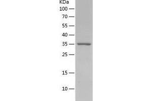 Western Blotting (WB) image for CD9 (CD9) (AA 110-192) protein (His-IF2DI Tag) (ABIN7122218)